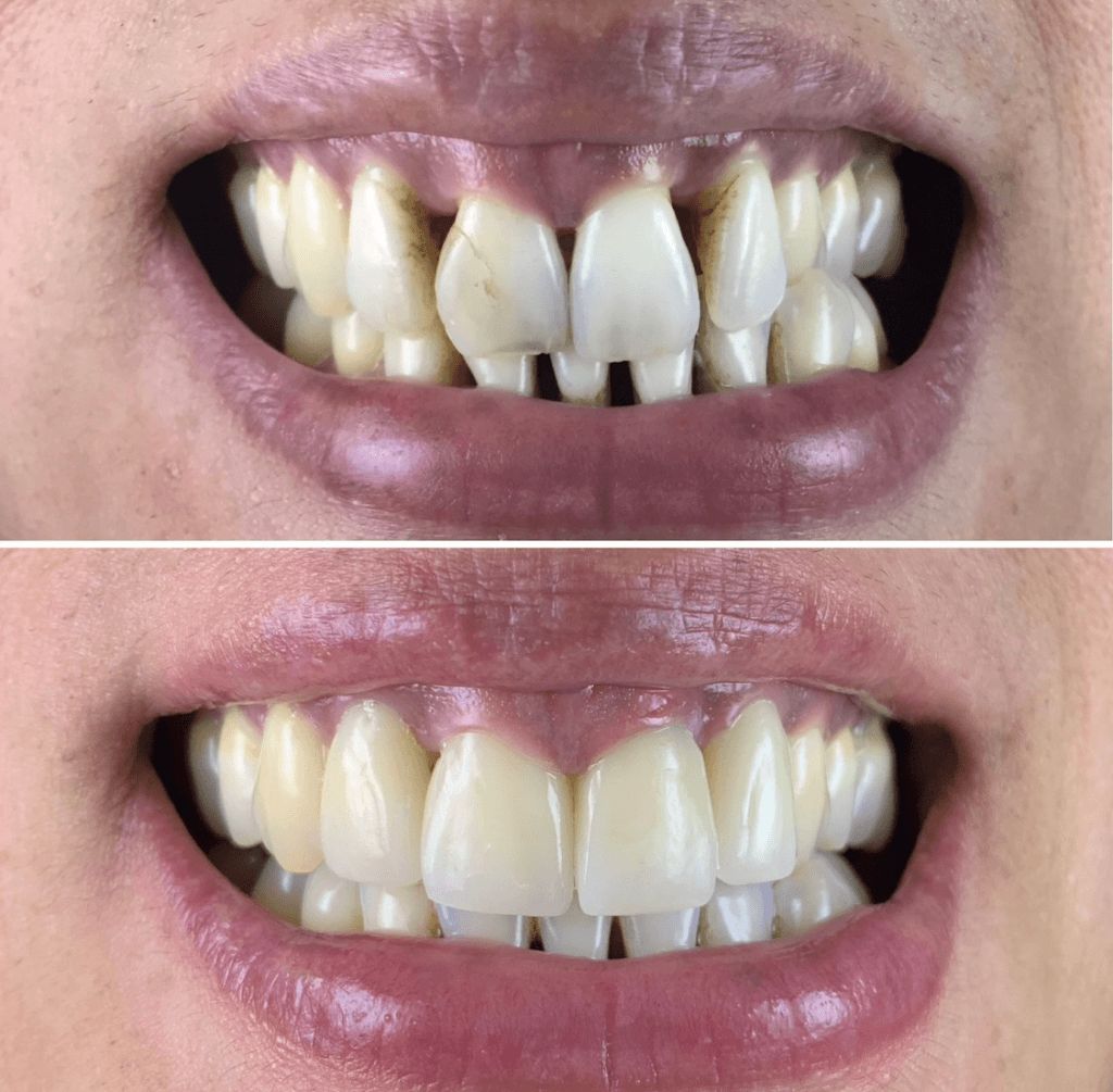 periodontologia-cl-nica-da-niza